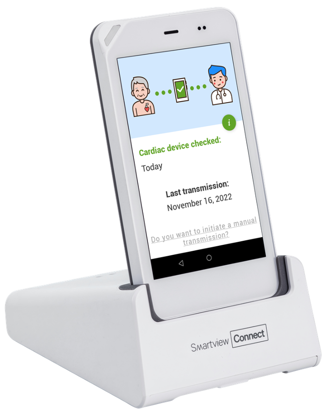 SmartView Connect™